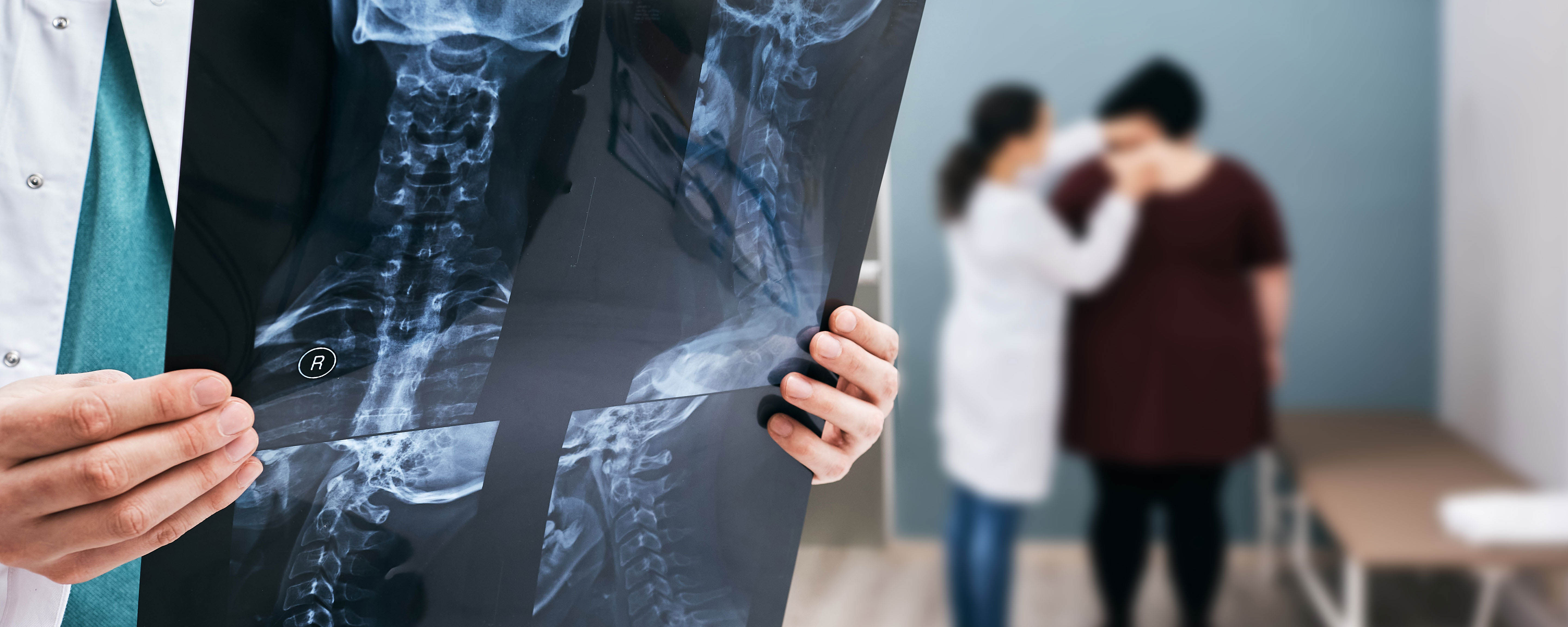 Doctor holding x-ray of spine with patients in background